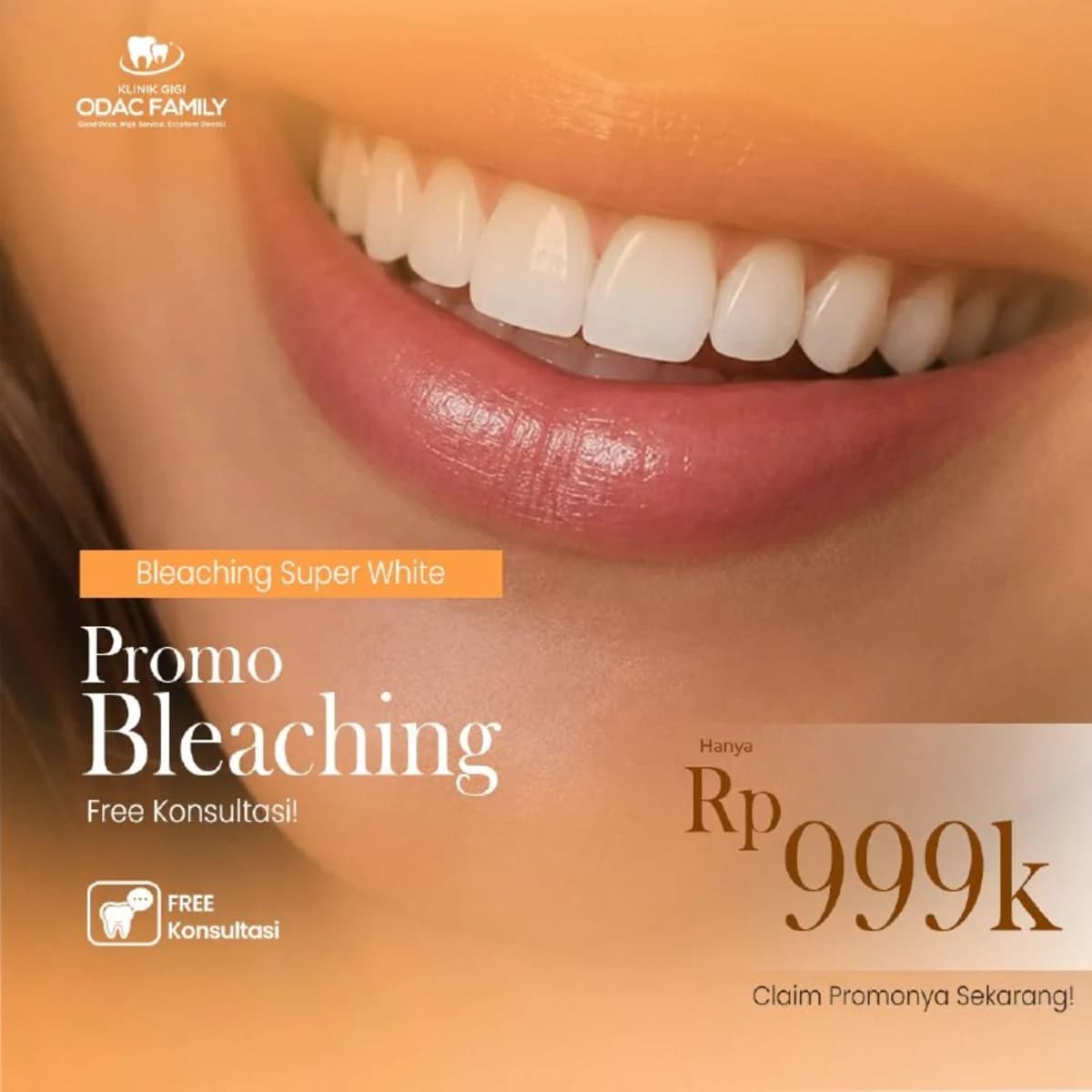 Promo Bleaching Super White Rp 999 Ribu di ODAC Family